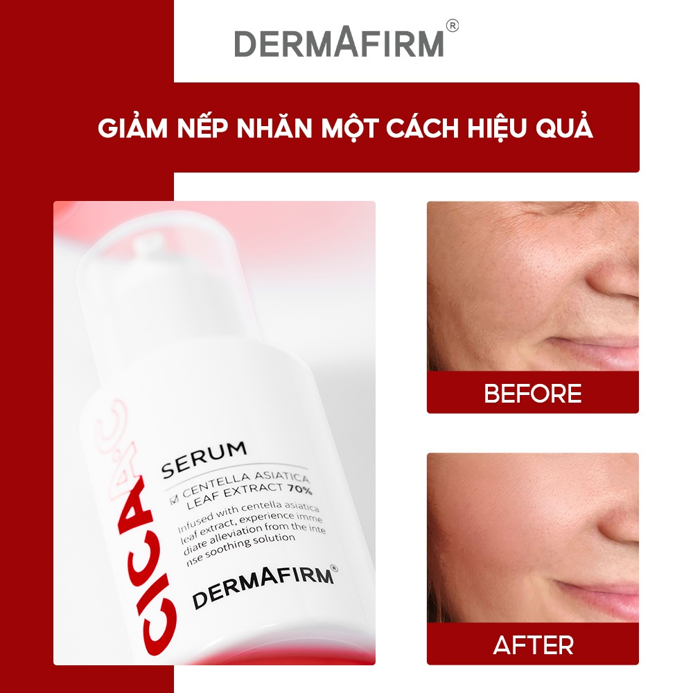 Tinh Chất Cấp Ẩm Chuyên Sâu, Làm Sáng Da, Làm Dịu Da DERMAFIRM CICAA.C SERUM 30ml