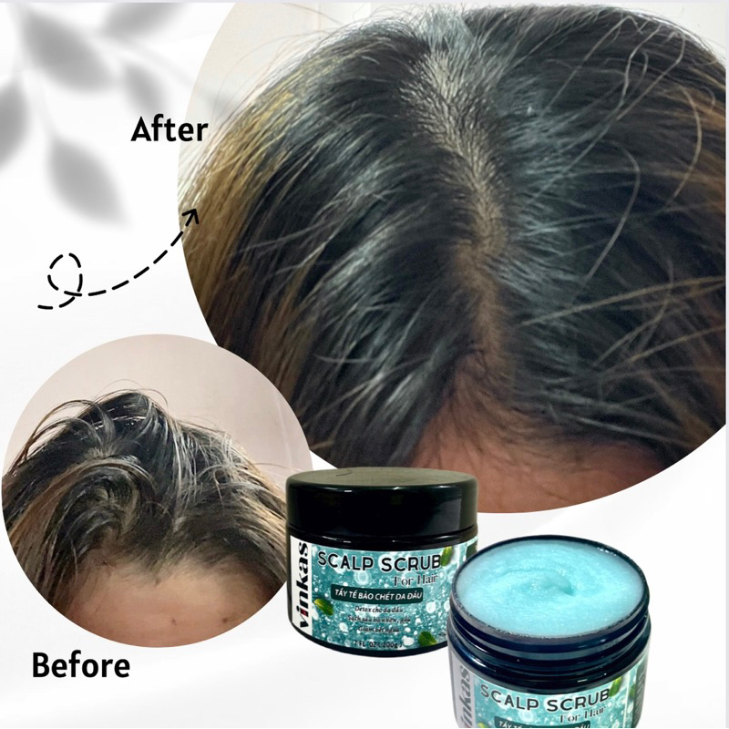 Tẩy Da Chết Da Đầu Giảm Bết Gàu Không Silicon VINKAS