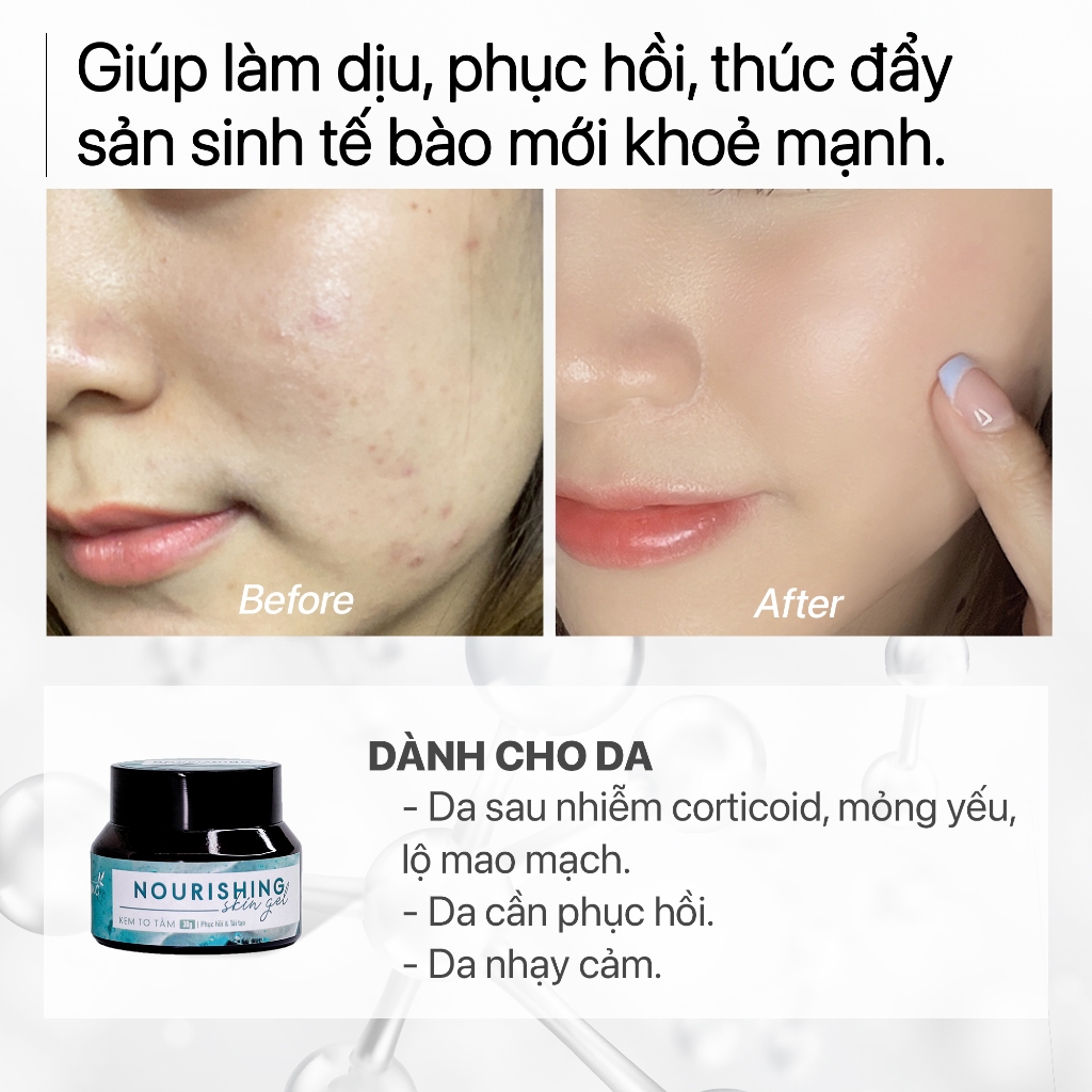 Kem dưỡng ẩm phục hồi tái tạo da chuyên sâu, làm dịu da nhạy cảm GUO - Nourishing Skin Gel GUO 30gr