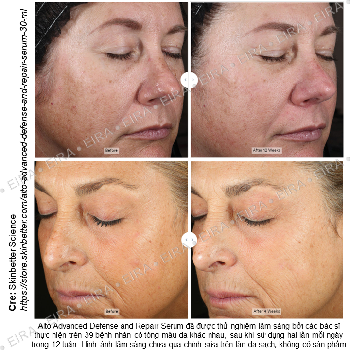 Tinh Chất Chống Lão Hóa, Phục Hồi, Làm Sáng Và Đều Màu Da Skinbetter Alto Advanced Defense And Repair Serum 15 ml