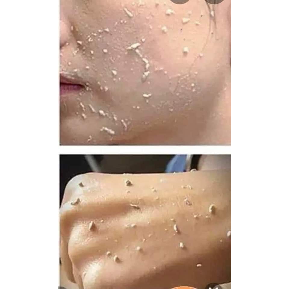 Tẩy da chết dịu nhẹ MAGIC SKIN