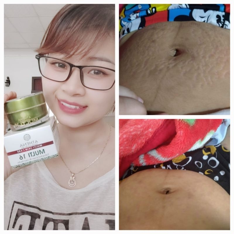 Combo 5 Kem Rạn Multi 16  loại 20gram [Tặng 1 hũ cùng loại]