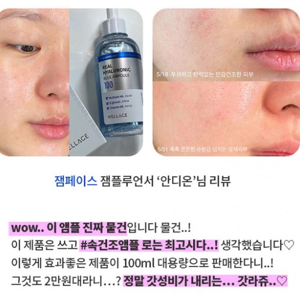 Bộ sản phẩm cấp nước WELLAGE Real Hyaluronic Blue 100 Ampoule