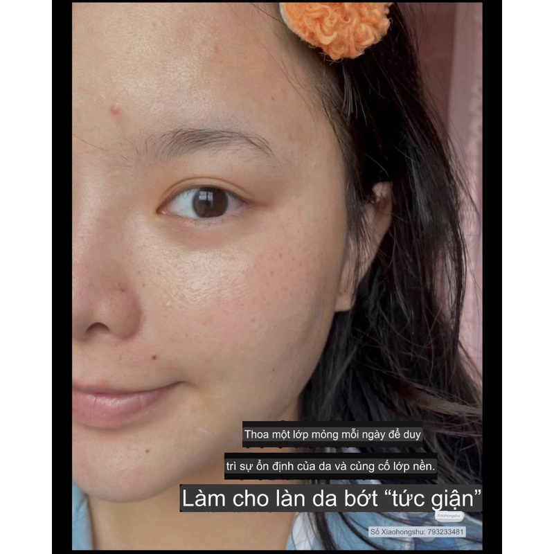 Sữa Dưỡng Ẩm Hypoallergenic Daily Moisture Therapy Lotion 50ml Physiogel Dành Cho Da Khô