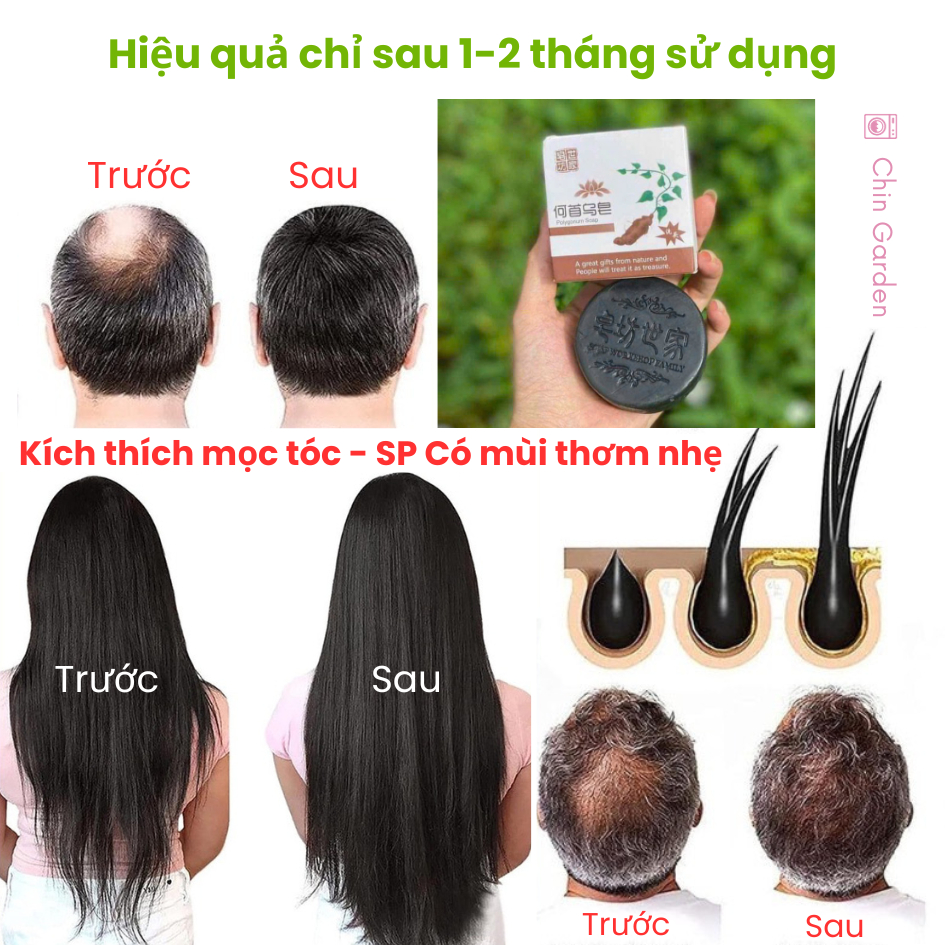 Xà Phòng Gội Đầu Kích Thích Mọc Tóc Hà Thủ Ô  Xà Bông Gội Đầu Hà Thủ Ô Chính Hãng Giúp Tóc Đen Mượt, Vào Nếp