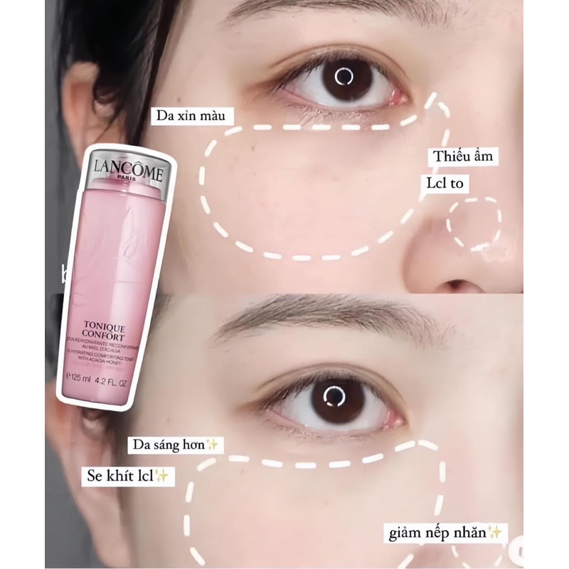 Toner Lancome 125ml vợt seo 2025