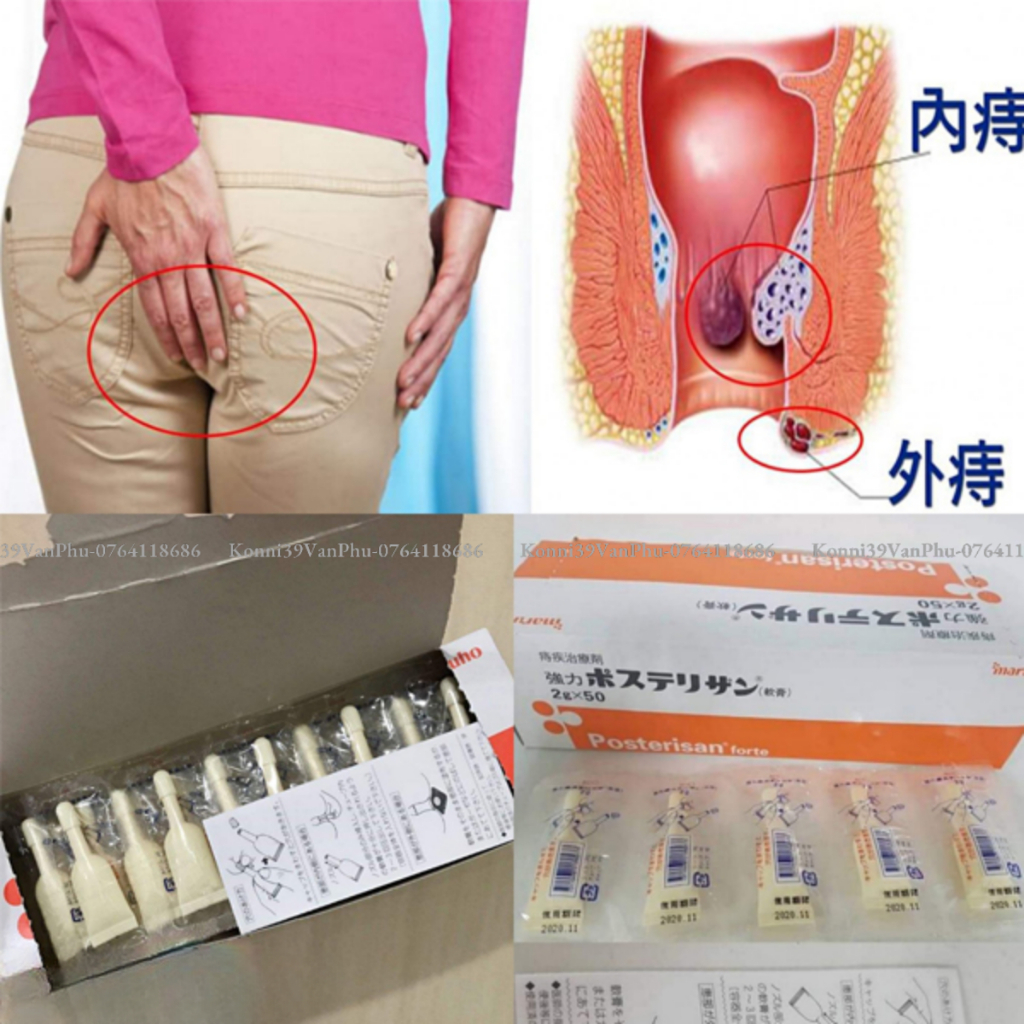 Kem bôi Trĩ Posterisan Forte Nhật Bản