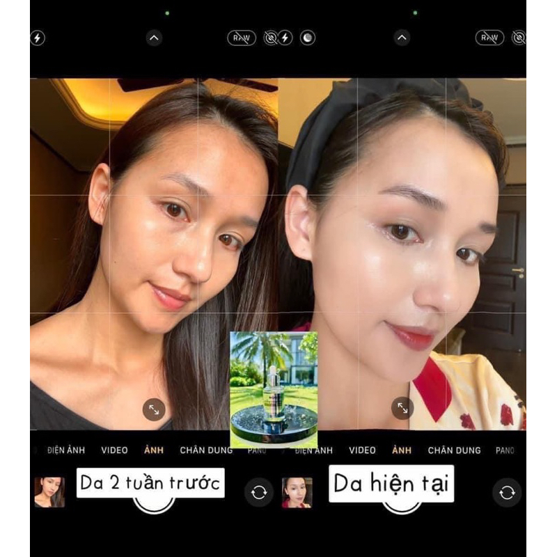 Combo peel moose+serum nám moose+ trọng lượng 50ml hạn dùng 2026