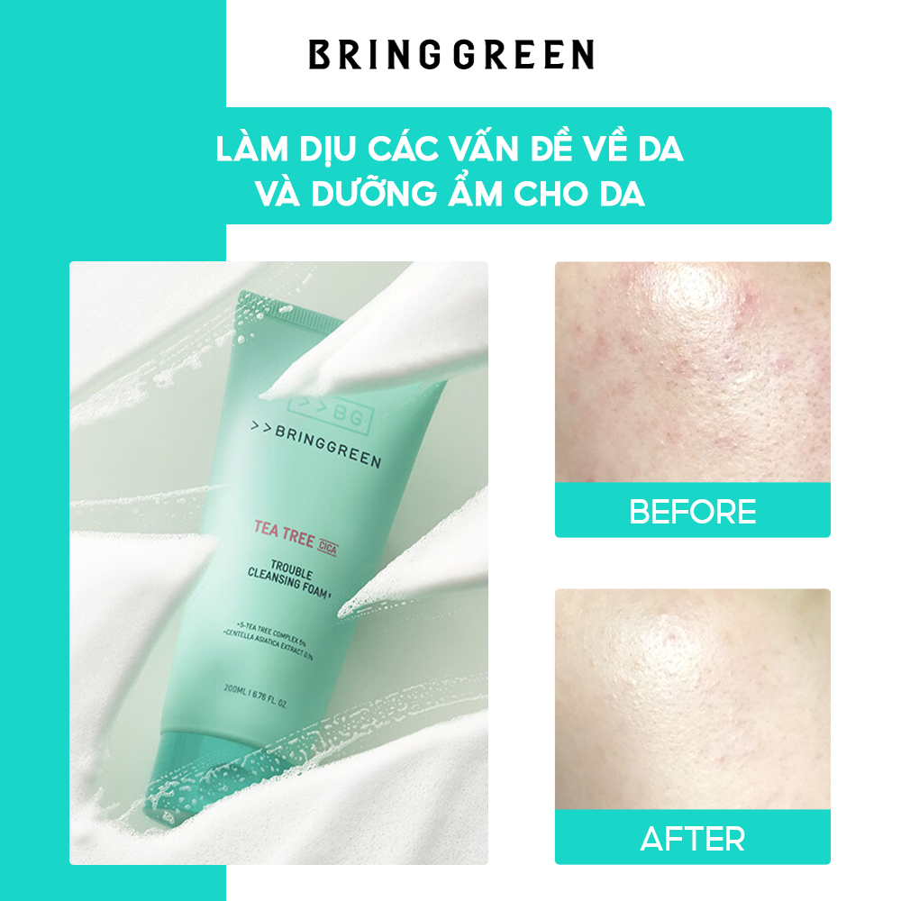 Sữa Rửa Mặt BRING GREEN TEA TREE CICA TROUBLE CLEANSING FOAM 200ML DOUBLE SET