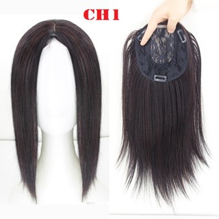 phủ hói không mái kèm hình chụp thật CH1