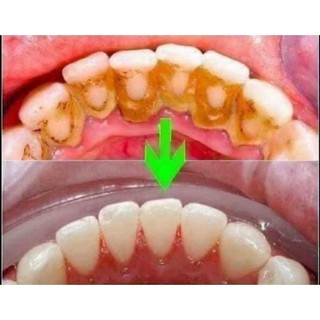 NƯỚC SÚC MIỆNG THẦN THÁNH 𝐏𝐑𝐎𝐏𝐎𝐋𝐈𝐍𝐒�