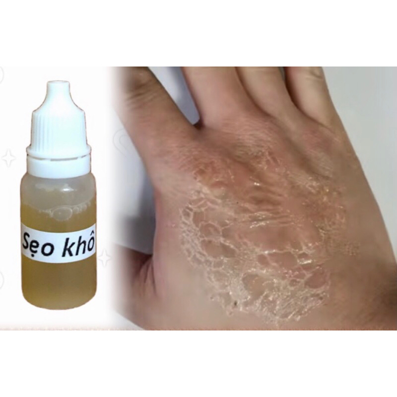 Vết thương sẹo giả hoá trang loại dán, máu khô, sẹo khô