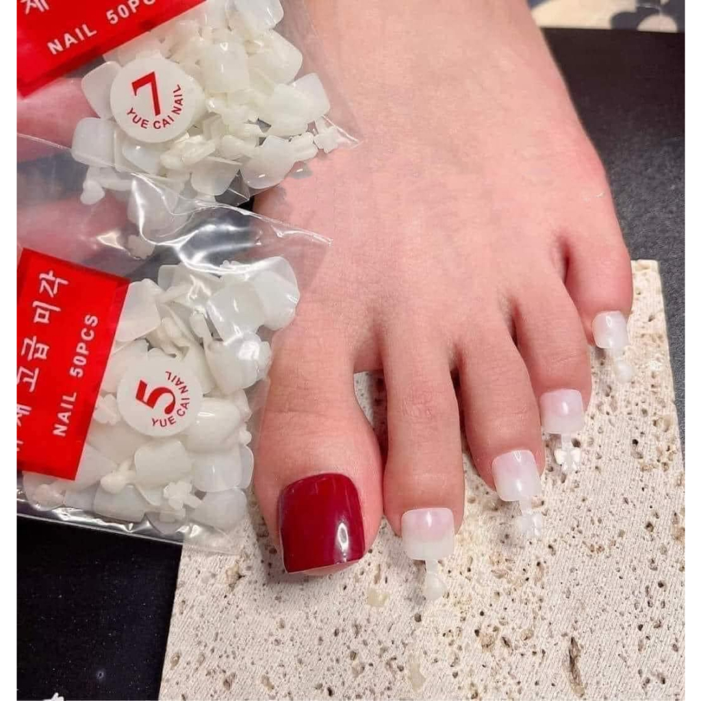 Móng úp chân ngắn