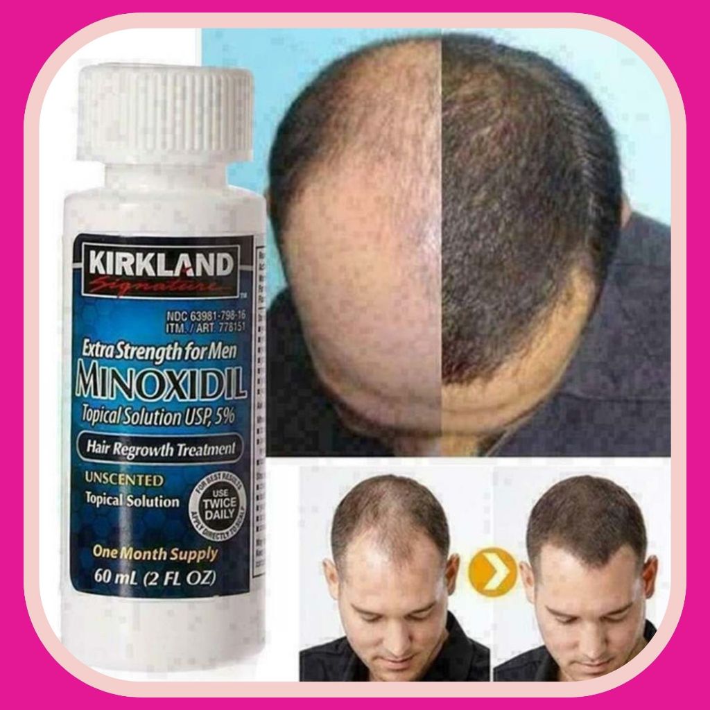 Minoxidil 5% Dạng Lỏng Mọc Râu Tóc Kirkland Mỹ (1 Hộp 6 lọ) bán sỉ