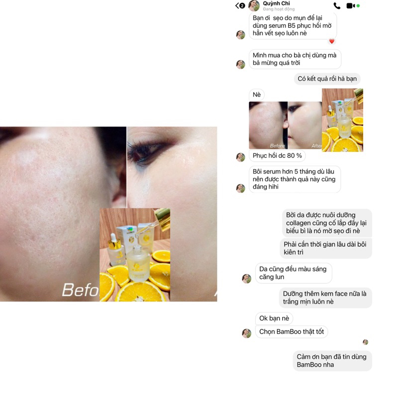🌼𝐂𝐡𝐢́𝐧𝐡 𝐇𝐚̃𝐧𝐠🌼Serum Dưỡng Ẩm Hyalu B5 30ml Bamboo - Siêu dưỡng ẩm, phục hồi da