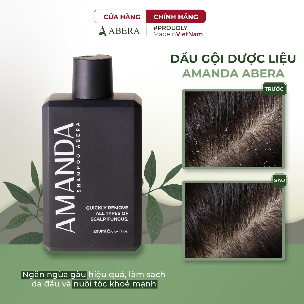 Dầu Gội Amanda Abera Xử Lý Nhanh Tình Trạng Gàu, Ngứa, Nấm Da Đầu Với Hương Thơm Nam Tính, Quyến Rũ - 200ml