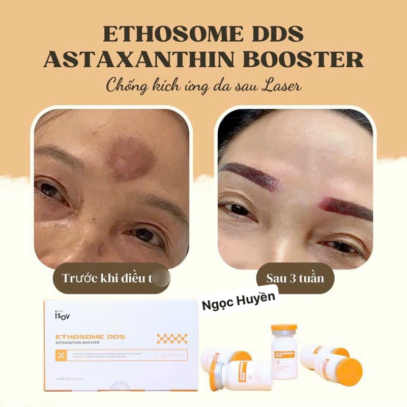 ETHOSOME DDS ASTAXANTHIN BOOSTER - CÔNG NGHỆ THOA NHƯ TlÊM  HỘP 5  LỌ