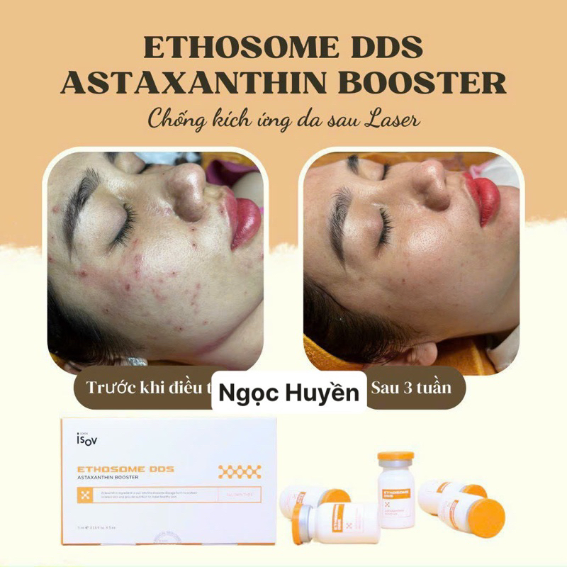 ETHOSOME DDS ASTAXANTHIN BOOSTER - CÔNG NGHỆ THOA NHƯ TlÊM  HỘP 5  LỌ