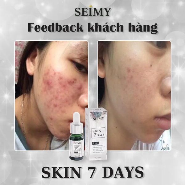 Seimy - Skin 7 Days Serum giảm mụn thâm rỗ công dụng sau 7 ngày