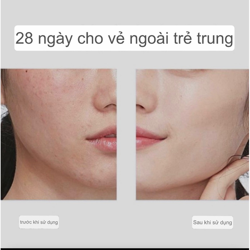 BỘT TINH CHẤT VITAMIN C