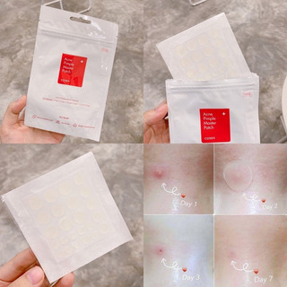 Miếng Dán Mụn COSRX Acne Pimple Patch 24 Miếng