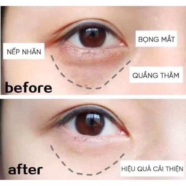 Kem dưỡng mắt Estee Lauder Advanced Night Repair Eye Supercharged Gel-Creme 5ml