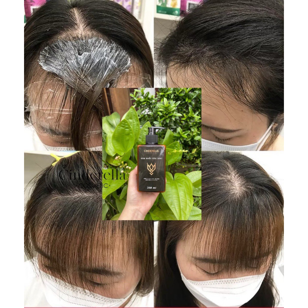 Áo duỗi phục hồi chuyên nghiệp tại nhà 2023