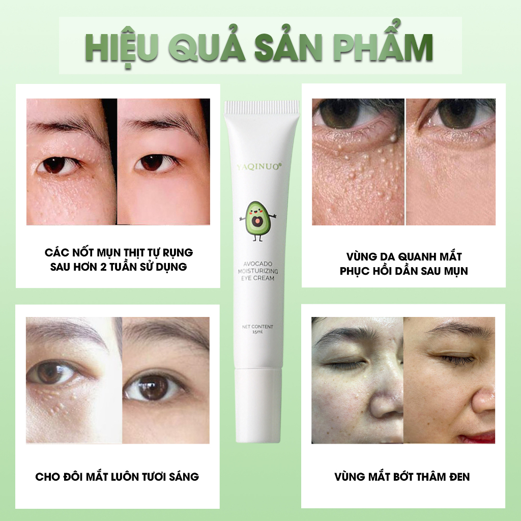 Kem mụn thịt liti dưỡng ẩm mắt Yakino săn chắc mắt, bọng mắt mờ nếp nhăn,quầng thâm - kem bơ giảm mụn thịt