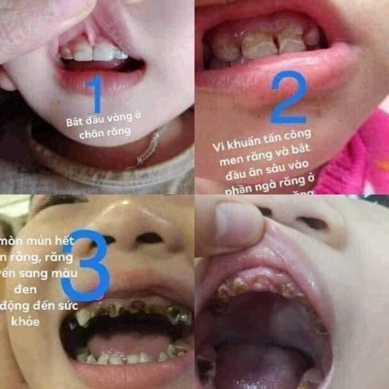 Tinh Dầu Răng Miệng Dạ Thảo Liên 5ml Thảo Dược Thiên Nhiên, Da Thao Lien Oral Essential Oil 100% natural 5ml -AnhKhoi_Du