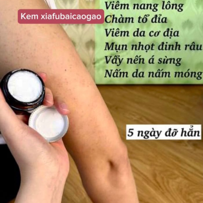 Kem Bôi Viêm Da Cơ Địa Đông Y XIAFUBAICAOGAO - Làm Dịu Da, Giảm Khô Ngứa, Chàm, Ghẻ, Á Sừng