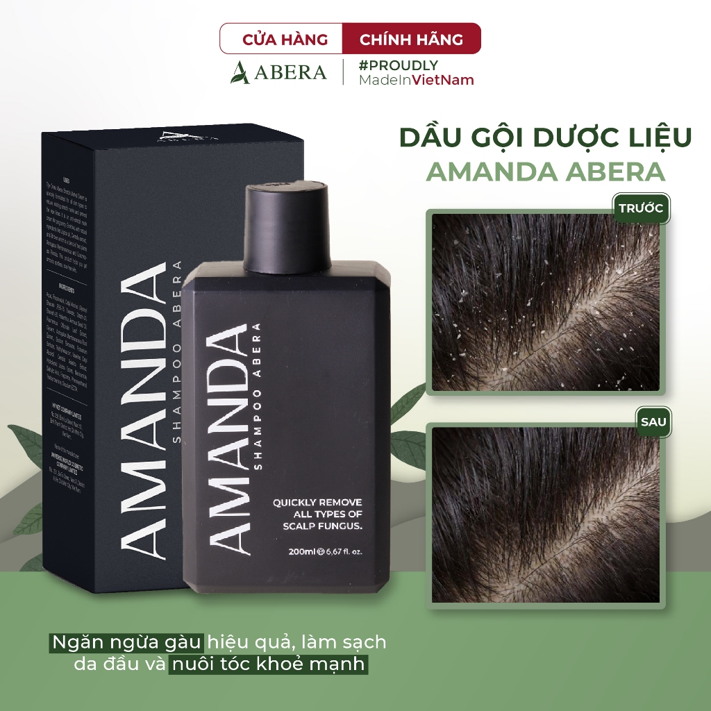 Dầu Gội Amanda Abera Xử Lý Nhanh Tình Trạng Gàu, Ngứa, Nấm Da Đầu Với Hương Thơm Nam Tính, Quyến Rũ - 200ml