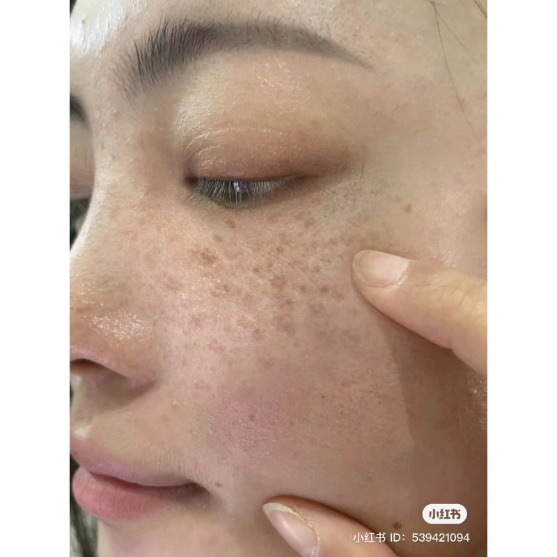 ❤️Siêu phẩm viên thoa huỷ nám, tàn nhang, chống nắng, trắng hồng da Laániy
