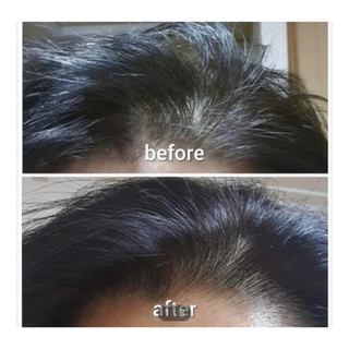 XỊT DƯỠNG KÍCH MỌC TÓC AROMATICA ROSEMARY ROOT ENHANCER 100ML