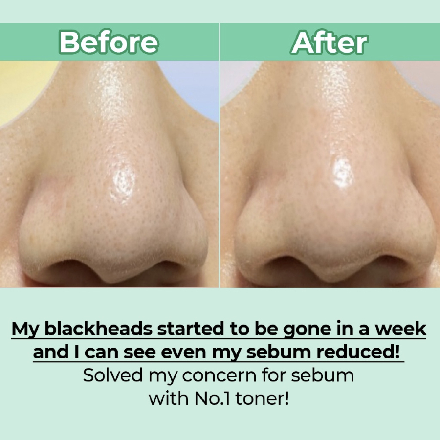 Toner Pad làm dịu da Numbuzin No.1 Centella Re-Leaf Green Toner Pad - 70 miếng