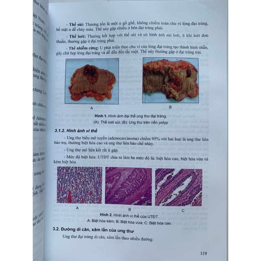 Sách - Bài giảng bệnh học ngoại y4
