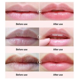 [ chính hãng ] Dưỡng Môi Vaseline Lip Therapy 7g ( dạng hủ )