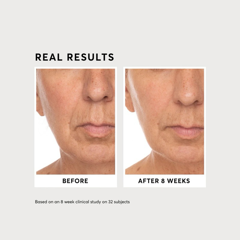 Serum phức hợp Vitamin C dưỡng sáng da, mờ thâm Naturium Vitamin C Complex Serum 30ml full box