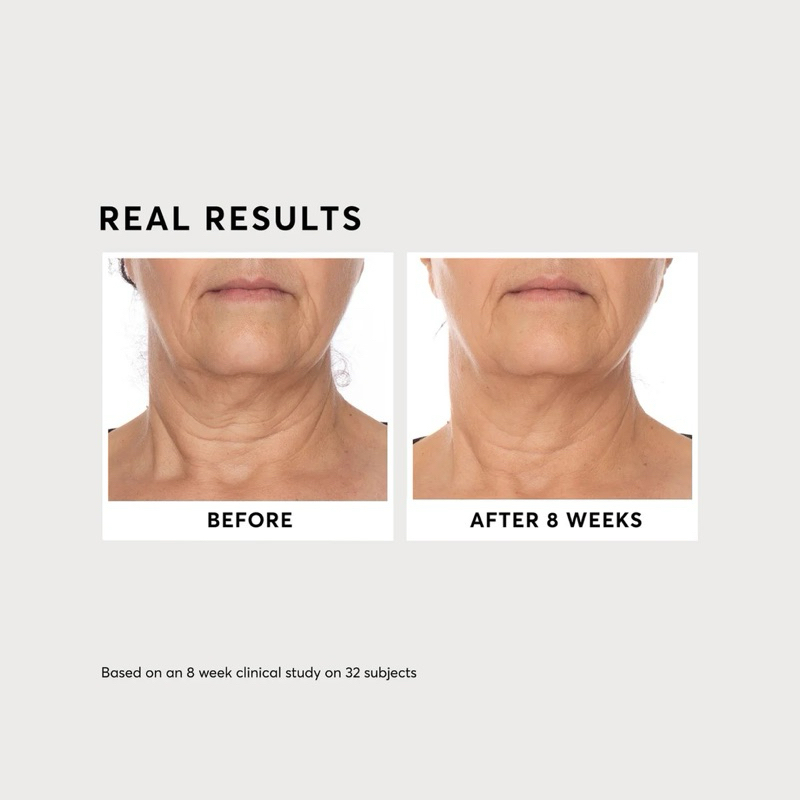 Serum phức hợp Vitamin C dưỡng sáng da, mờ thâm Naturium Vitamin C Complex Serum 30ml full box