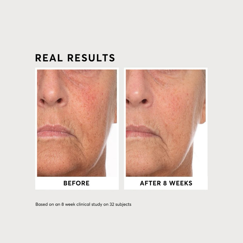 Serum phức hợp Vitamin C dưỡng sáng da, mờ thâm Naturium Vitamin C Complex Serum 30ml full box