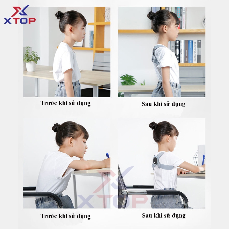 Đai Lưng Chống Gù Rung Cảm Biến Điện Tử Thông Minh Cao Cấp XTOP V008