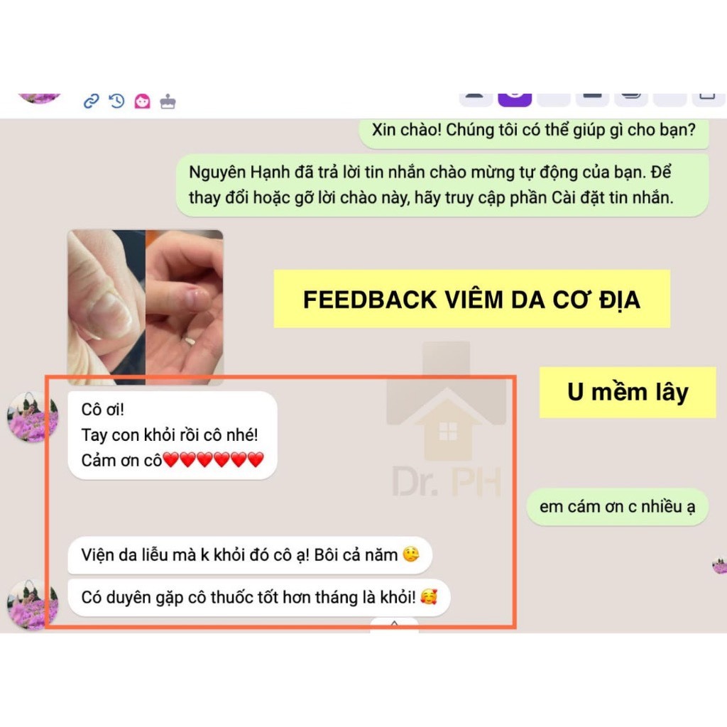 Kem Bôi Viêm Da Cơ Địa Đông Y XIAFUBAICAOGAO