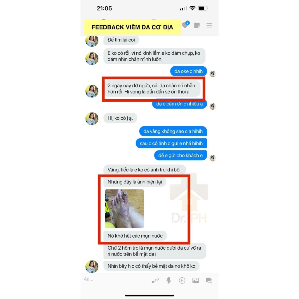Kem Bôi Viêm Da Cơ Địa Đông Y XIAFUBAICAOGAO
