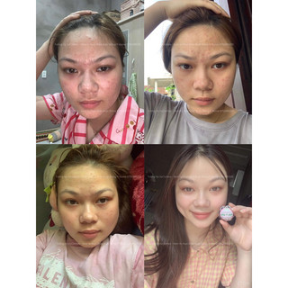 Kem mụn, nám, tàn nhang, dưỡng da thảo dược hoa đào Đông Y Home - Tường Vy VyClothes
