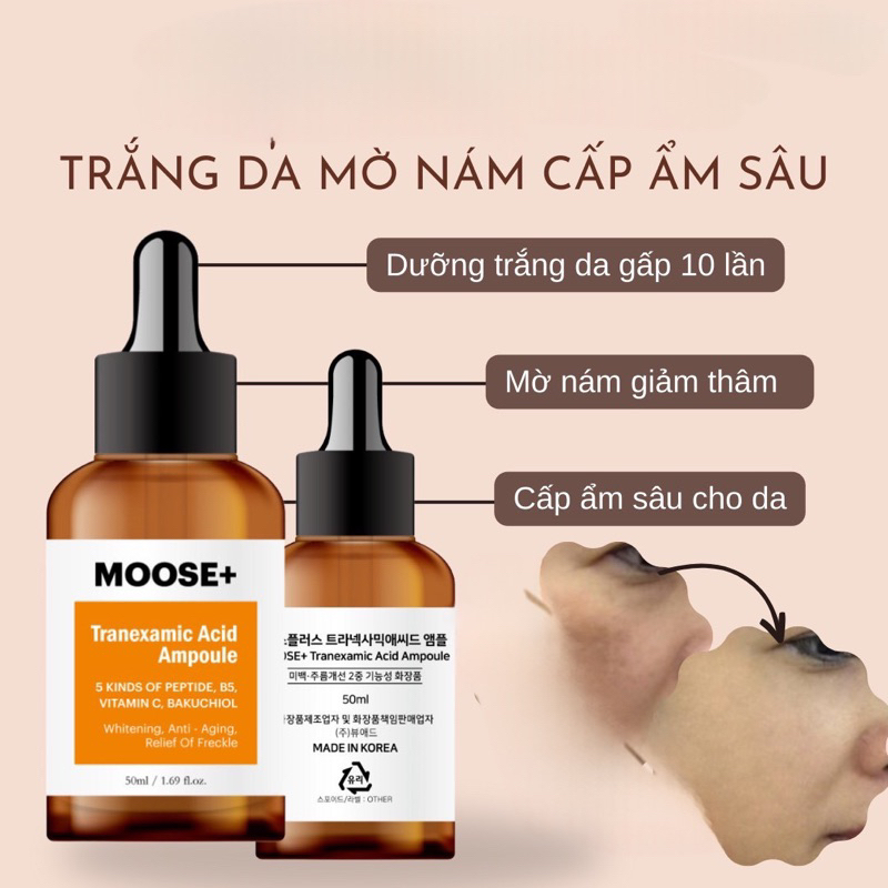Serum nám moose+ xoá nám  50ml hạn dùng 2026