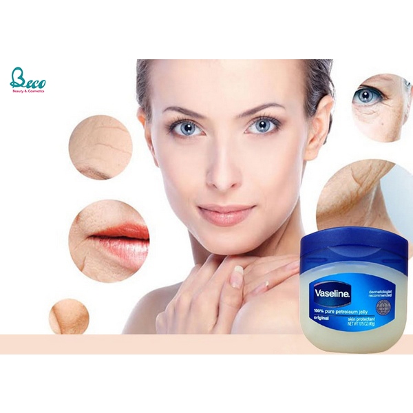 Vaseline dưỡng môi, Vaseline kem nẻ, Vaseline kem đa năng mùa đông