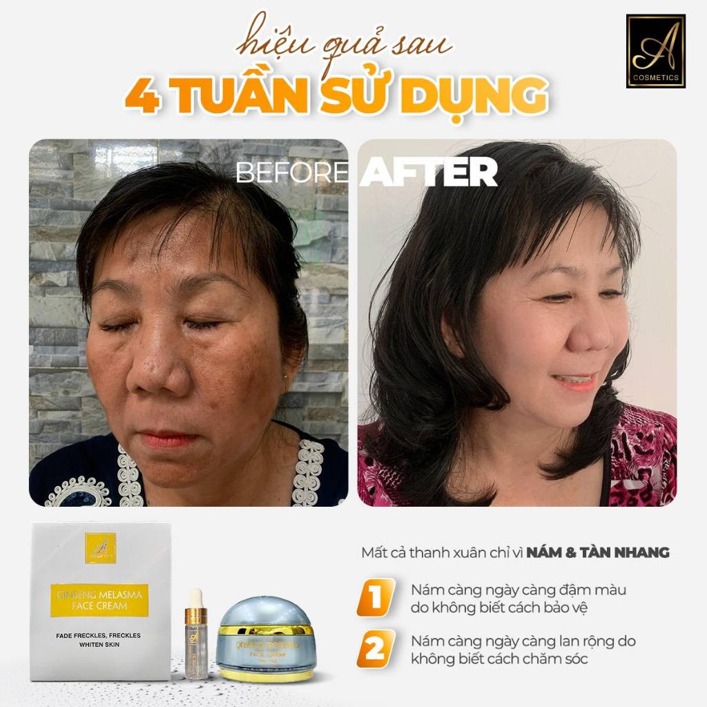 Kem dưỡng trắng da mặt,Face nám nhân sâm Ginseng Melasma Face Cream Acosmetics, giúp ngừa nám tàn nhangng, 25g
