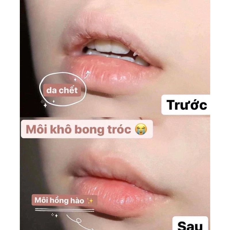 Son dưỡng môi Bioderma