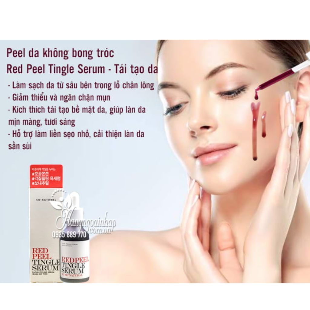 Tinh Chất Tẩy Da Chết Hóa Học So' Natural Red Peel Tingle Serum 11ml