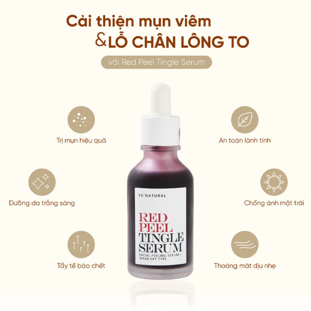 Tinh Chất Tẩy Da Chết Hóa Học So' Natural Red Peel Tingle Serum 11ml