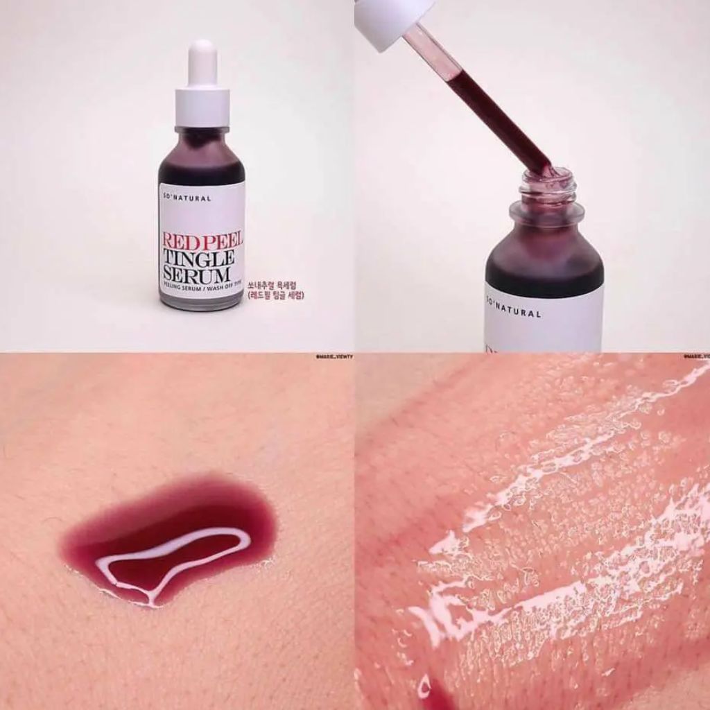 Tinh Chất Tẩy Da Chết Hóa Học So' Natural Red Peel Tingle Serum 11ml